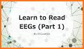 EEG Tutorial related image