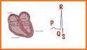 ECG Basics - Learning and interpretation made easy related image