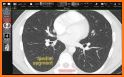 Surgical Anatomy of the Lung related image