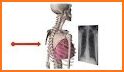 Easy Chest X-Ray related image