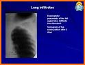 X-Ray Differential Diagnosis related image