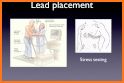 Clinical ECG Guide. related image