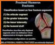 AO/OTA Fracture Classification related image