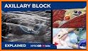 NYSORA Nerve Blocks related image