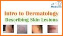 Model Dermatology for Skin Disease related image