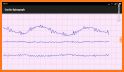 Cardio Spirograph related image