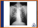 X-Ray Differential Diagnosis related image