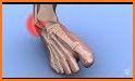 SWOLLEN FEET HOME REMEDIES related image