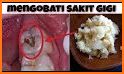 tips simpel cara mengatasi radang gusi saat hamil related image