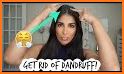 Get Rid of Dandruff related image