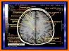 CT Passport Head/Brain / sectional anatomy / MRI related image