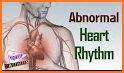 Cardiac diagnosis (heart rate, arrhythmia) related image