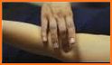 Learn Acupressure Points Acupuncture Tips related image