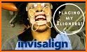 Invisalign Photo Uploader related image