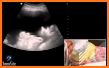 Ultrasound GUIDE - Free Library related image