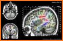 Medical Atlas - Medical Imaging & Radiology Tool related image