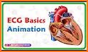 ECG in Motion – The innovative ECG education-tool related image