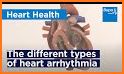 ECG Rhythm and Pulse related image