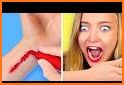 Accident Prank Photo Editor - Fake Injury On Body related image