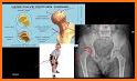 Pocket Tutor: Musculoskeletal Imaging related image