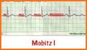 ECG Basics - Learning and interpretation made easy related image