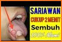 tips simpel cara mengatasi sariawan pada balita related image