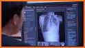 Navi Radiography Lite related image