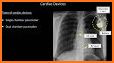 Chest X-Ray And Pathology related image