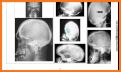 A-Z Chest X-Ray Interpretation related image