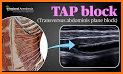 Block Tap Tap related image