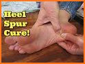 How to Get Rid from Heel Pain related image