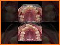 Dentist & Braces doctor - Mouth care surgery related image