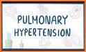 Hypertension: Causes, Diagnosis, and Management related image