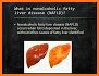 Fatty Liver Risk - Screening of Liver Health related image