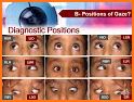 Ocular Motility Disorders, 4 related image