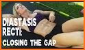 Diastasis Recti Exercises related image