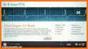 ECG Stat related image