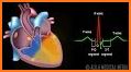 ECG in Motion – The innovative ECG education-tool related image