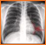 CHEST RADIOLOGY related image