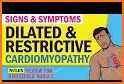 Cardiomyopathy: Exam Review concepts and quiz. related image