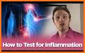 How to Reduce Inflammation related image