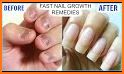 How to Grow Nails Fast related image