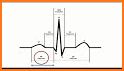 Electrocardiogram (ECG) Rhythm App: Corrected QT related image