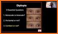 Ocular Motility Disorders, 4 related image