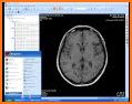 Dicom Viewer related image