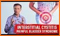 Interstitial Cystitis related image