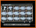 Interactive CT and MRI Anatomy related image