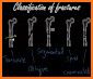 AO/OTA Fracture Classification related image