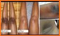 Get Rid Of Dark Knees And Elbows Fast & Naturally related image