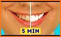 Tips Dientes Blancos related image